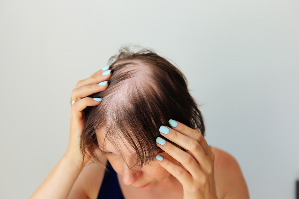 Énorme perte de cheveux après grossesse : dois-je m'inquiéter ?