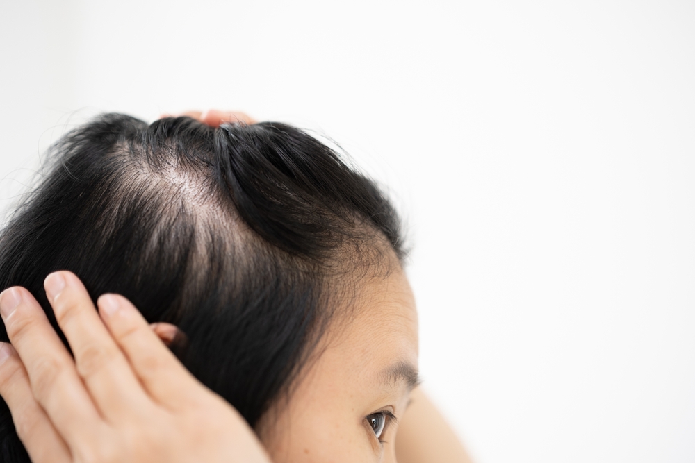 Existe-t-il un remède miracle contre la chute des cheveux ?
