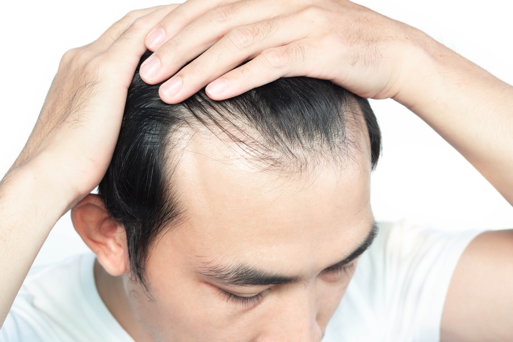 Qu'est-ce que les cheveux clairsemés ? Quelle signification ?