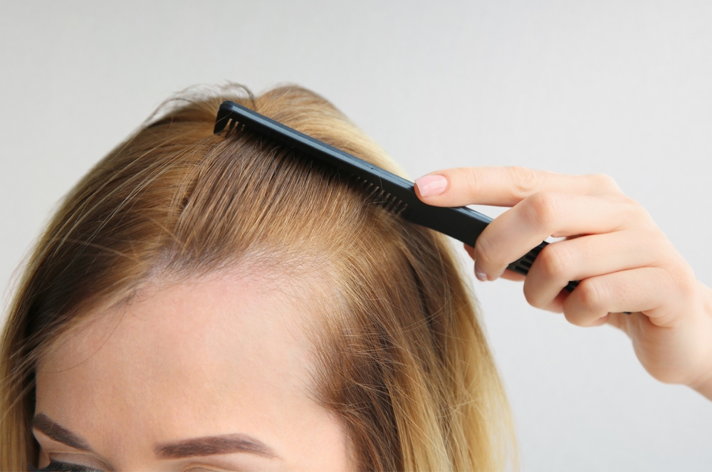Grossesse et perte de cheveux : solutions pendant et après