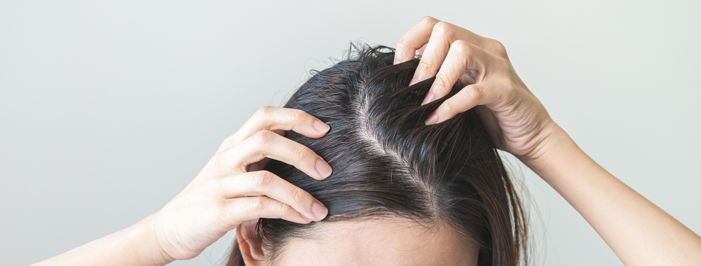 Les causes les plus fréquentes de la perte de cheveux chez la femme