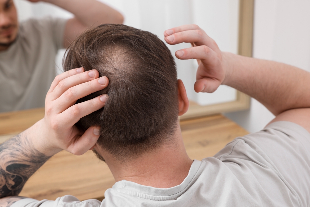 Chute de cheveux