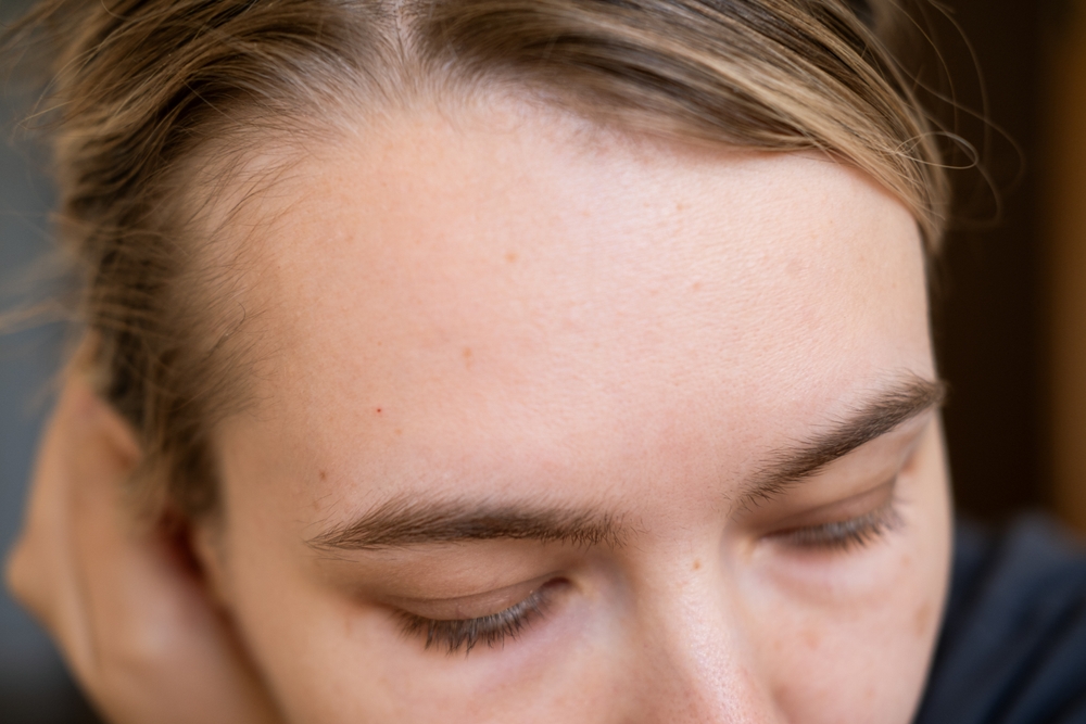 Perte de cheveux post-partum : le guide complet pour la comprendre