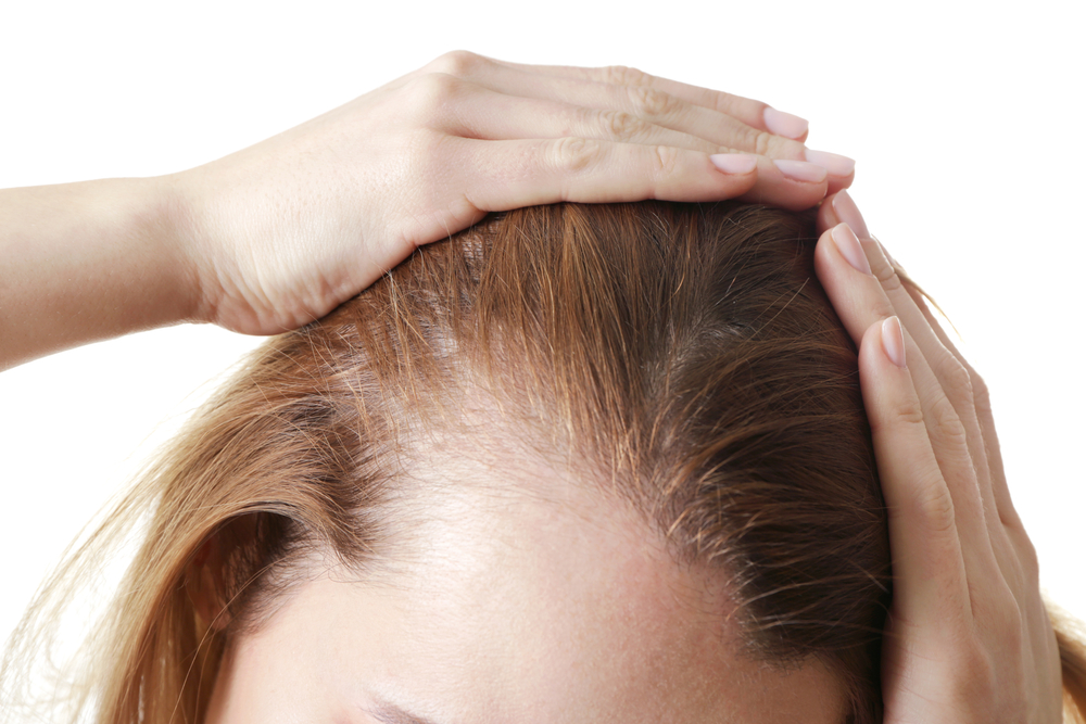 Perte de cheveux : les signes à surveiller